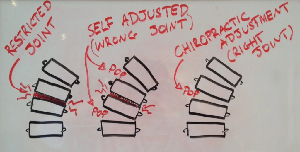 Chiropractic Cocoa Beach FL Whiteboard Diagram